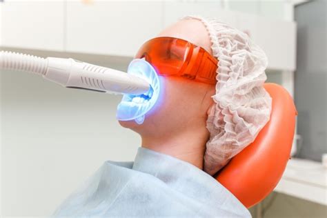 How Laser Teeth Whitening May Affect Tooth Colored Restorations - Thanasas Family Dental Care ...