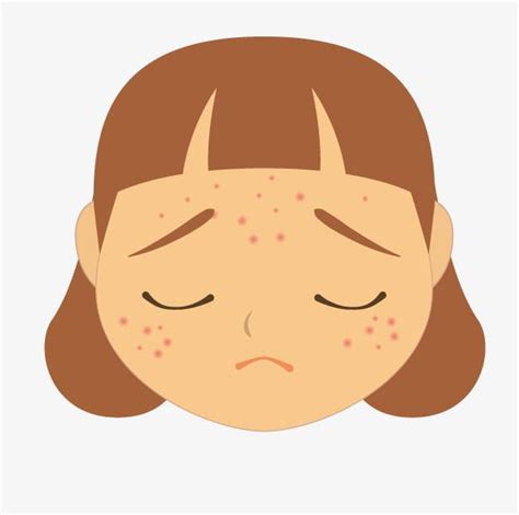 Acne Facial, Face Acne, Acne Reasons, White Blood Cell Count, Demodex, Acne Vulgaris, Stress Causes