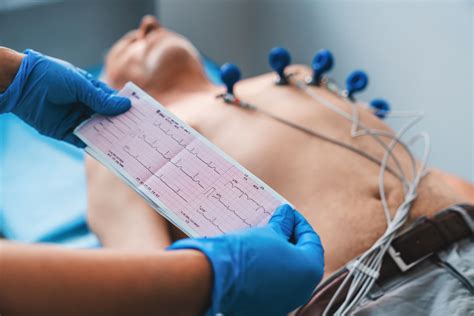 Electrocardiogram,,Ecg,In,Hand.,Cardiogram,Printout,On,Male,Patient ...