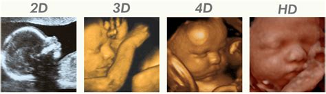 Best Time To Do 3d Ultrasound During Pregnancy | jeminileywhenilookatyou