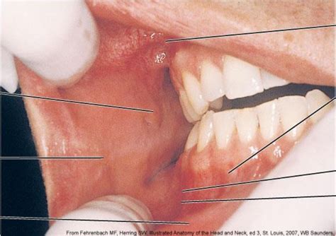 Vestibules of the oral cavity with its landmarks Diagram | Quizlet