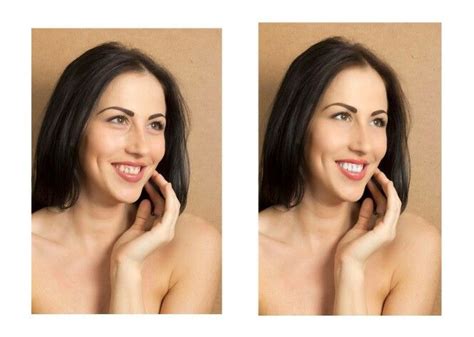 Before after teeth repair | Tooth repair, Holistic dentistry, Dentistry