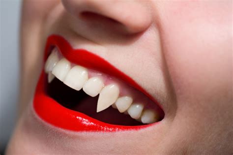 Vampire teeth! (this one is really long, sorry xD) - Image and Photo Touch-ups | Dental implants ...