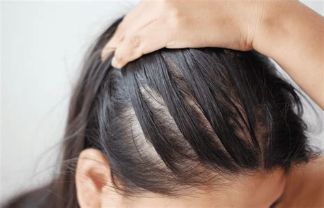 6 Dermatologist-Approved Ways to Outsmart Thinning Hair