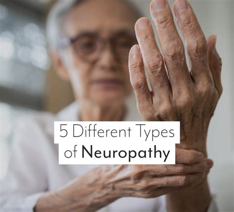 5 Different Types of Neuropathy — Integrated Pain Management