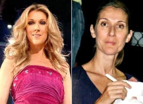 Celine Dion Without Makeup | Saubhaya Makeup