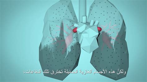 منظمة الصحة العالمية: تنفس الحياة (BreatheLife) - كيف يؤثر تلوّث الهواء ...