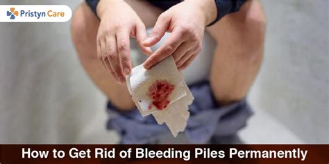 How to Get Rid of Bleeding Piles Permanently - Pristyn Care