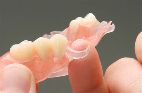 Flexible Partial Denture Repair