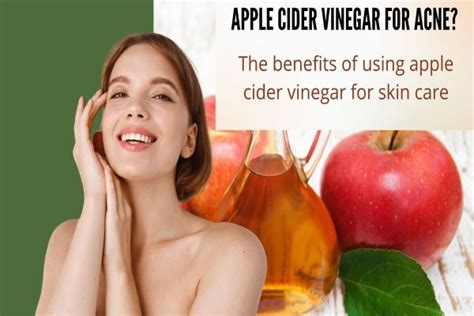 Apple cider vinegar for Acne? The benefits of using apple cider vinegar ...