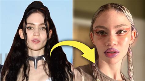 Grimes Admits to Plastic Surgery: Is this the Start of the New ...