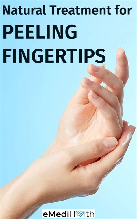 Peeling Fingertips: Causes, Home Remedies, and Prevention Tips ...