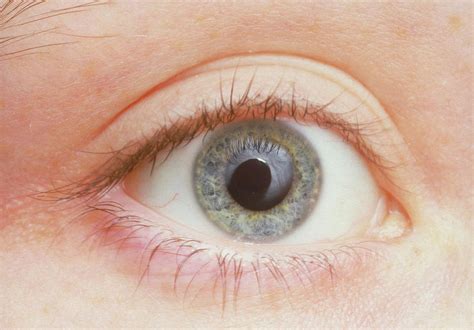 Human Eye Showing Dilated Pupil Photograph by Martin Dohrn/science ...