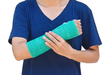 Scaphoid Fracture Cast Or Splint