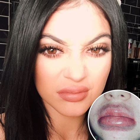 Kylie Jenner Lip Challenge Produces Terrifying Results - E! Online - UK