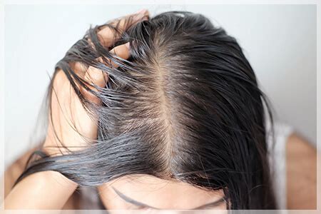 【医師監修】女性の頭頂部の薄毛の原因と改善策 - 【公式】AGAスキンクリニックレディース