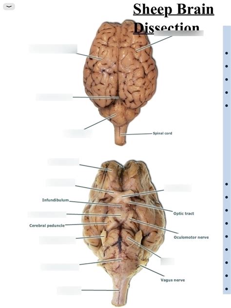 Sheep Brain Dissection 1 Diagram | Quizlet