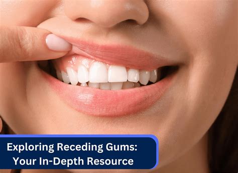 Exploring Receding Gums: Your In-Depth Resource - smizel