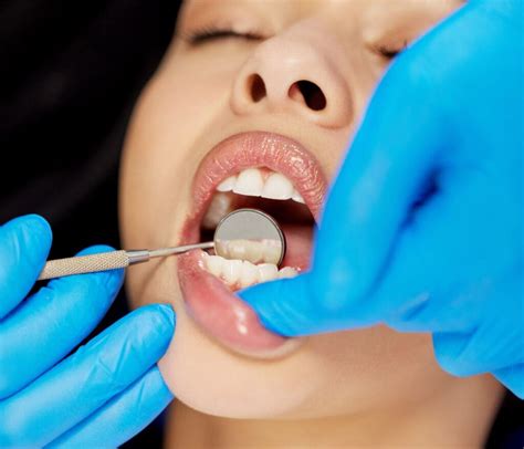 What You Need to Know When Recovering from Laser Gum Surgery ...