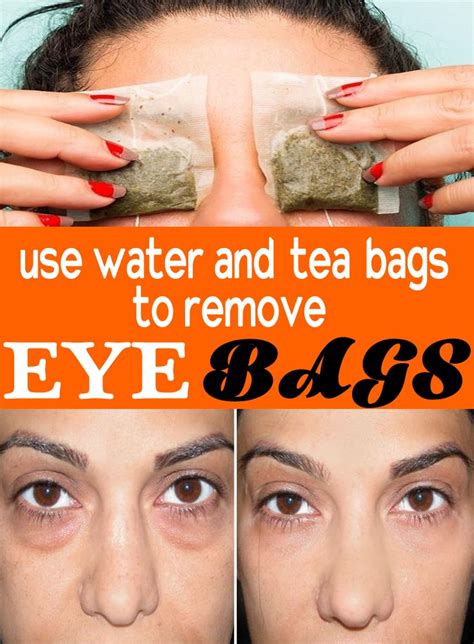 How To Get Rid Of Bags Under Eyes Fast Best Home Remedies - Natural remedies