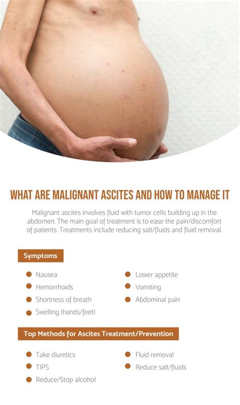 What Is Malignant Ascites And How To Manage It - Fatty Liver Disease