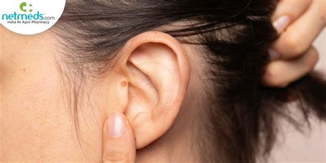 Ear Cancer: Causes, Symptoms And Treatment