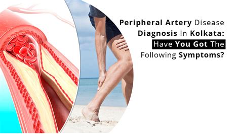 Peripheral Artery Disease Diagnosis In Kolkata: Have You Got The Following Symptoms?