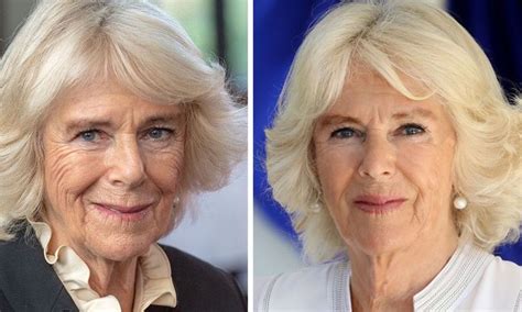 Camilla Parker underwent plastic surgery ahead of her coronation as the new Queen of England