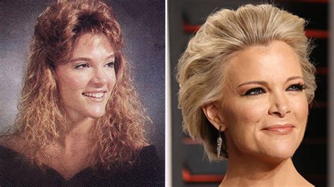 [PICS] Megyn Kelly Nose Job — Did She Get Plastic Surgery? See Photos ...