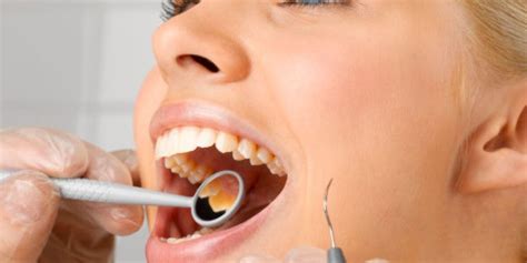 ¿En qué consiste una limpieza dental profunda y cuándo hay que hacerla? - Clinica Dental Palomero