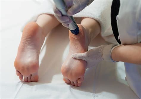 What You Need to Know About Foot Surgery | Southeast Orthopedic Specialists