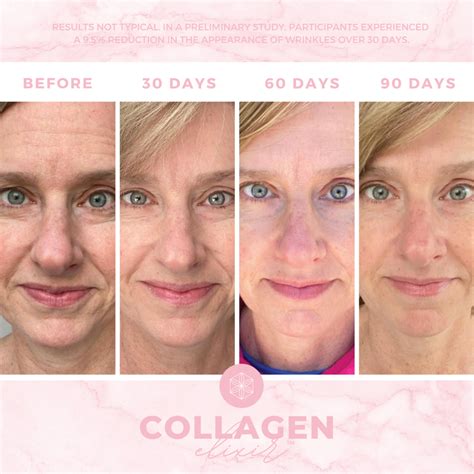 Isagenix Collagen Elixir Before and After Collection - Collagen Beauty Elixir