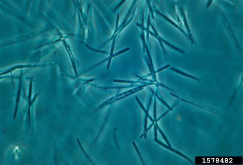 Septoria leaf spot (Septoria petroselini)