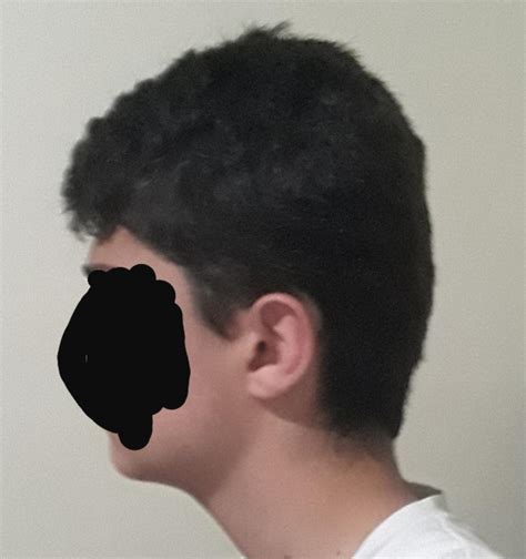 Flat Back Of Head Hairstyle Suggestion - what hairstyle is best for me