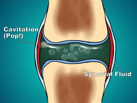 Popping-Sounds-Explained - Lancaster Chiropractors - AV Chiropractic ...