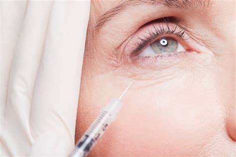 Botox Clinic Etobicoke | Mimico Medical Botox Injections