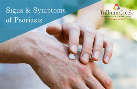 Signs & Symptoms of Psoriasis - Trillium Creek Dermatology