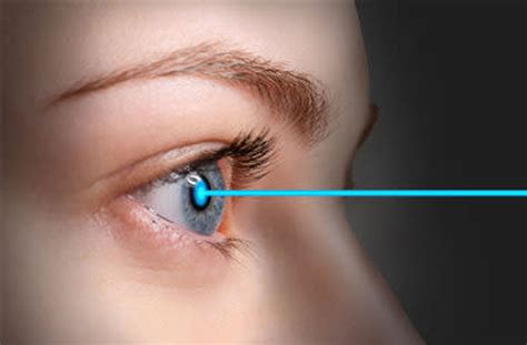 Laser Eye Surgery for Astigmatism in Melbourne | NewVision Clinics