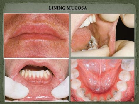 ammaarahxyburrows51a - mucous membrane colour chart kvetforum kvet ...