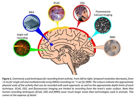 How Does Fmri Work In The Study Of Brain Activity - Study Poster