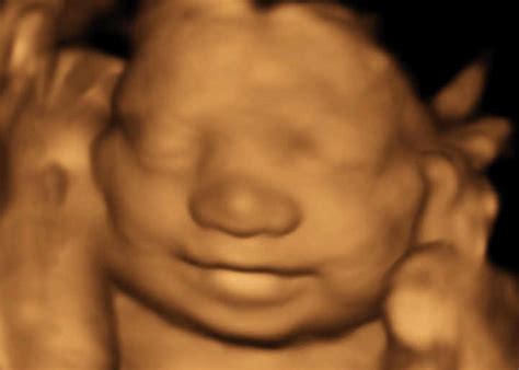 3dbabybump » 3D Baby Bump Ultrasound and Photography Palm Beach