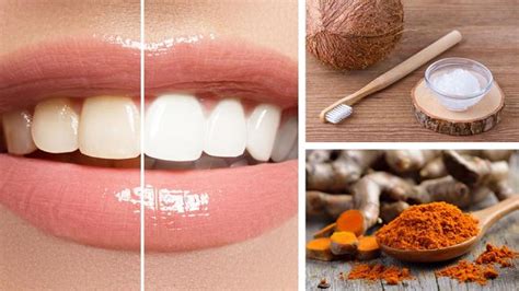 Is Turmeric Good For Your Teeth - Teeth Poster