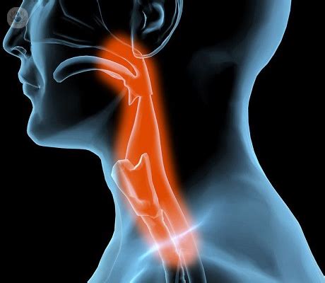 Dificultad de deglución: padecimiento común | Top Doctors