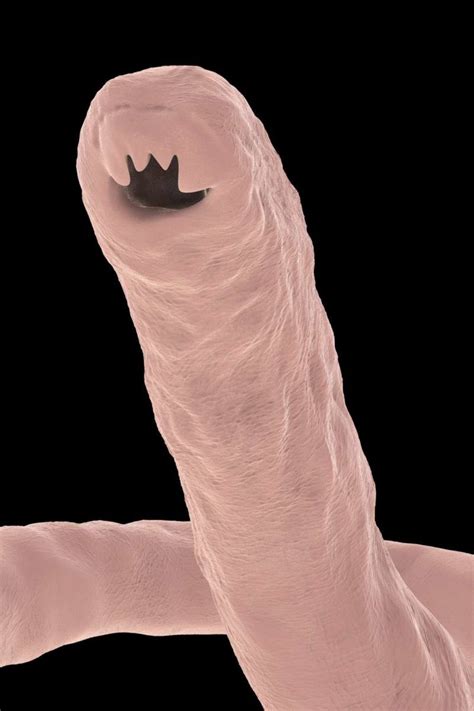 Hookworm Infection: Causes, symptoms, and treatment