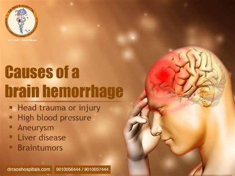 Brain Haemorrhage Symptoms, Causes and Treatment https://msgeniustools ...