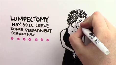 Hidden Scar Lumpectomy at Wellstar - YouTube