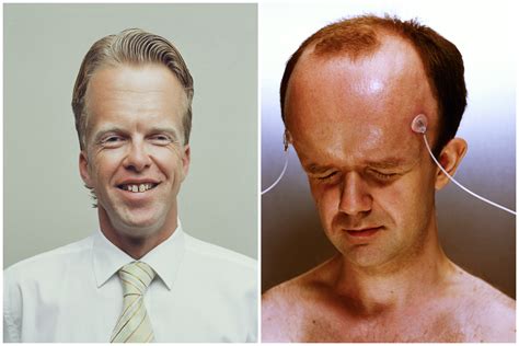 Who has the biggest forehead in the world? Everything you need to know - YEN.COM.GH