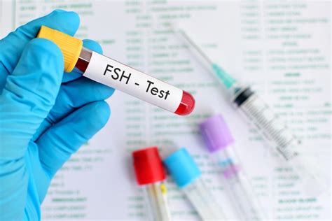 A Comprehensive Overview of the Follicle-Stimulating Hormone (FSH) Test - GoFameUs