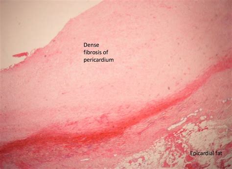 Pericardium Histology