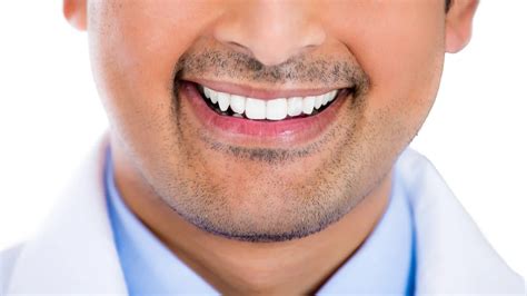 How to Fix Vampire Teeth With Cosmetic Dentistry | Shining Smiles Family Dentistry